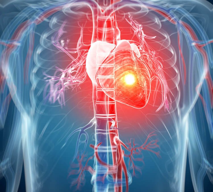 Treatment Image
